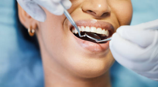 Best Knocked-Out Tooth (Avulsed Tooth) Treatment in West Mayfield, PA